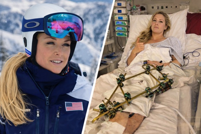Lesión de Lindsey Vonn