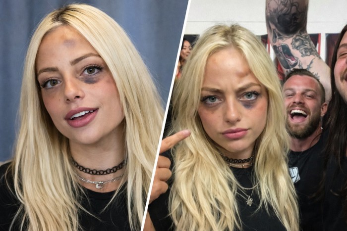 Lesión de Liv Morgan