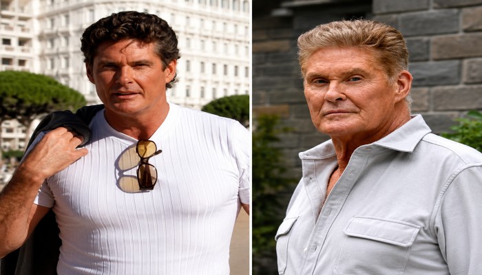 Problemas de salud de David Hasselhoff: Última actualización sobre su estado