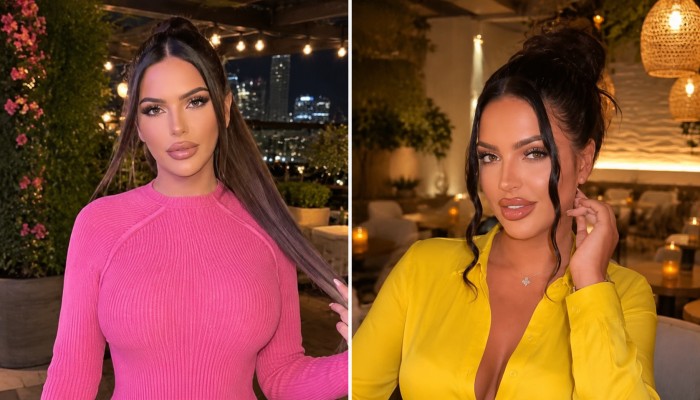 Klaudia Glam: 5 Claves Sobre su Vida y el Accidente que Conmocionó a sus Fans